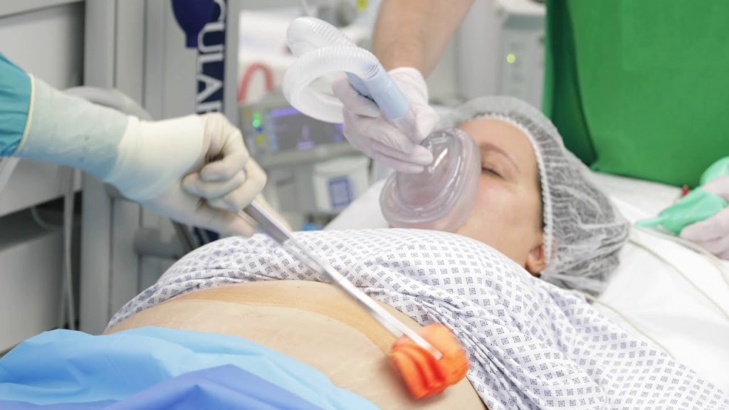 How to Choose the Gastric Sleeve Best Clinic Turkey for Safe Weight Loss
